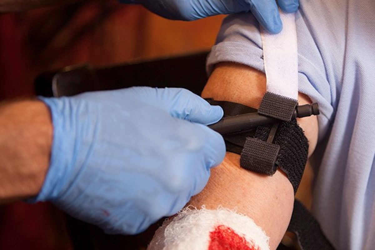 Emorragie da ferite da guerra. Lâ€™utilizzo del Tourniquet cosâ€™Ã